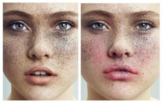 Freckle Tastic- Ines Garcia By Frauke Fischer For Push It #7b.jpg