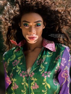 Winnie-Harlow-Editorial03.jpg