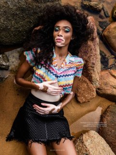 Winnie-Harlow-Editorial07.jpg