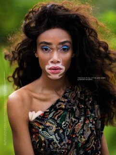 Winnie-Harlow-Editorial10.jpg