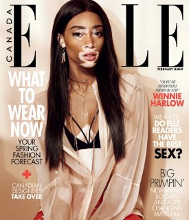 ELLE-Canada-February-2017-Winnie-Harlow-by-Nelson-Simoneau-1.jpg