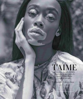 winnie-harlow-harpers-bazaar-mexico-november-2018-8.jpg