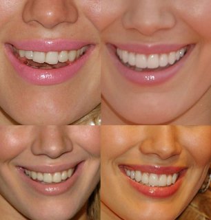 teeth2lp.jpg