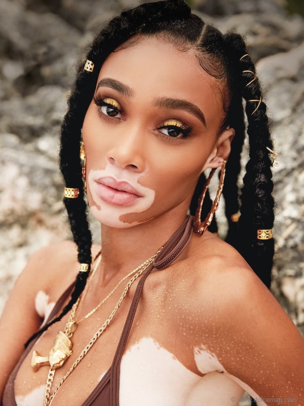 Winnie-Harlow_2_by-MAX-PAPENDIECK-min.jpg