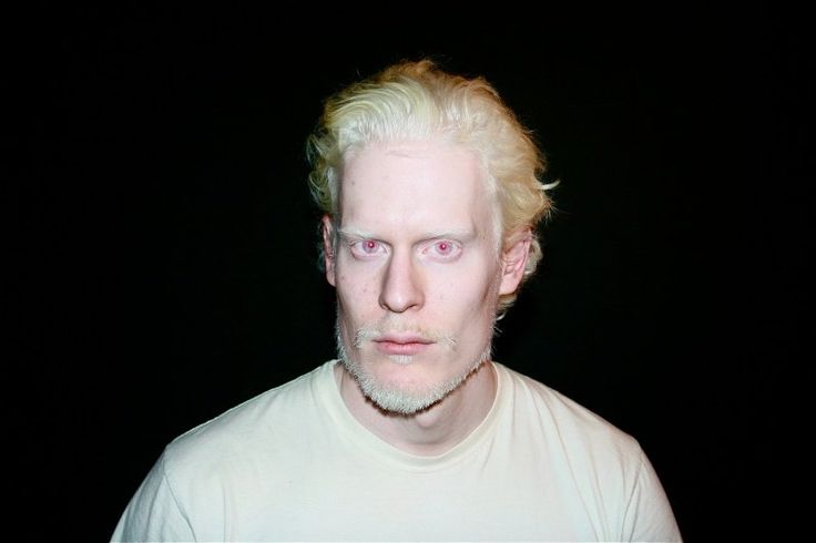 4e9f9f7b1a0864919db70bfe6d48b5e1--stephen-thompson-albino-model.jpg