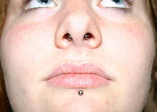 Septum.jpg