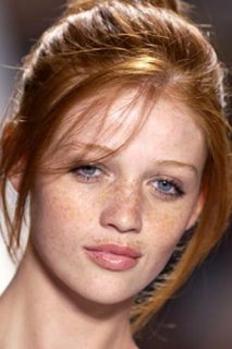 freckles.jpg