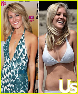 heidi-montag-boob-job.jpg