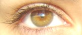 my eye.JPG