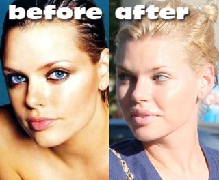 sophie-monk-plastic-surgery.jpg